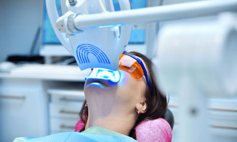 Teeth Whitening In El Paso & Horizon City, TX - Dentist Near Me